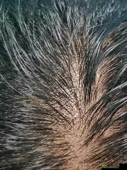 舌头搅拌时疼痛,温热环境加剧:可能的原因及应对方法